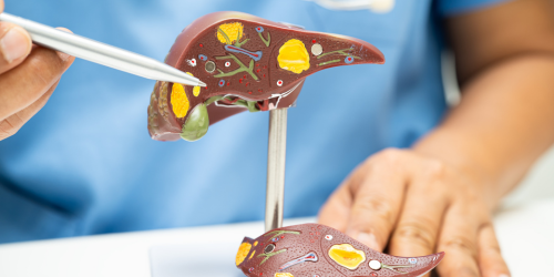 Hepatobiliary